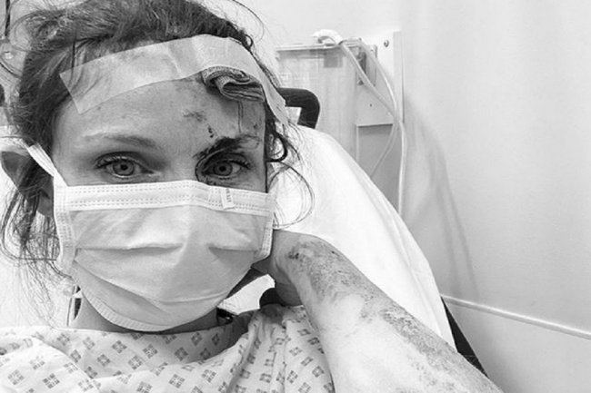 Певица Софи Эллис-Бекстор госпитализирована с травмами головы - «Новости Музыки»